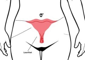 uterine infection
