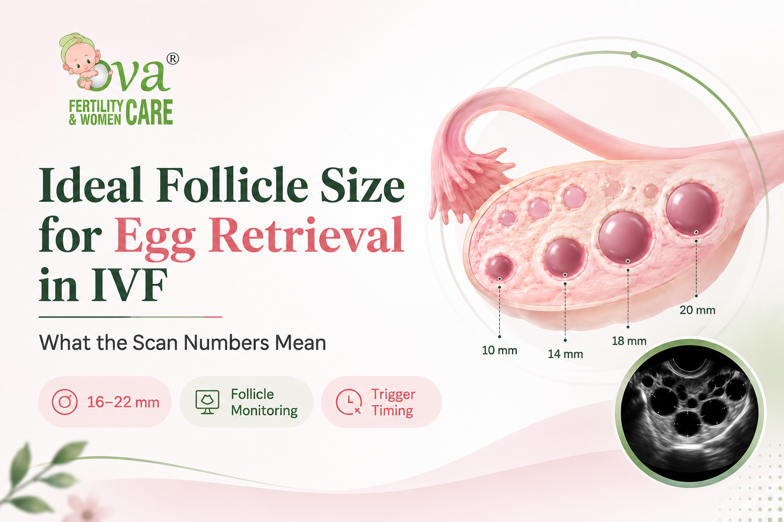 Ideal Follicle Size for Egg Retrieval in IVF: What the Scan Numbers Mean